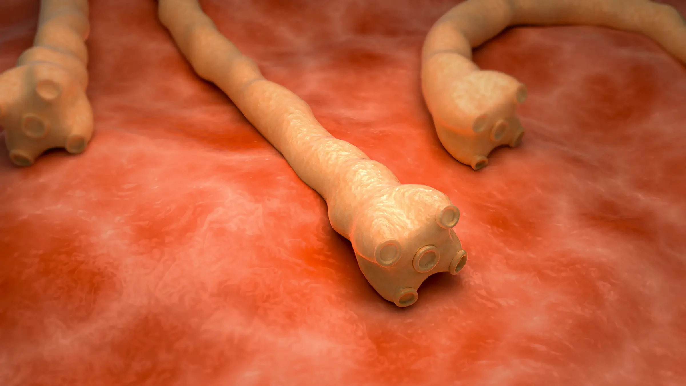 Tapeworms Are for Real. I Had One and You Could, Too.